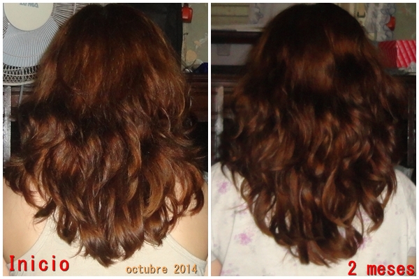 La cabeza suda la caída de los cabello